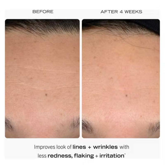 0.3% Retinol Complex Serum With Peptides by First Aid Beauty