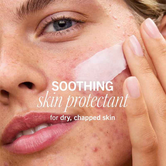 Ultra Repair Rescue Barrier Balm by First Aid Beauty