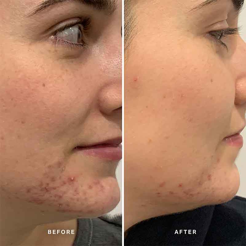Clear Skin Tonic 2% Salicylic Acid & Niacinamide