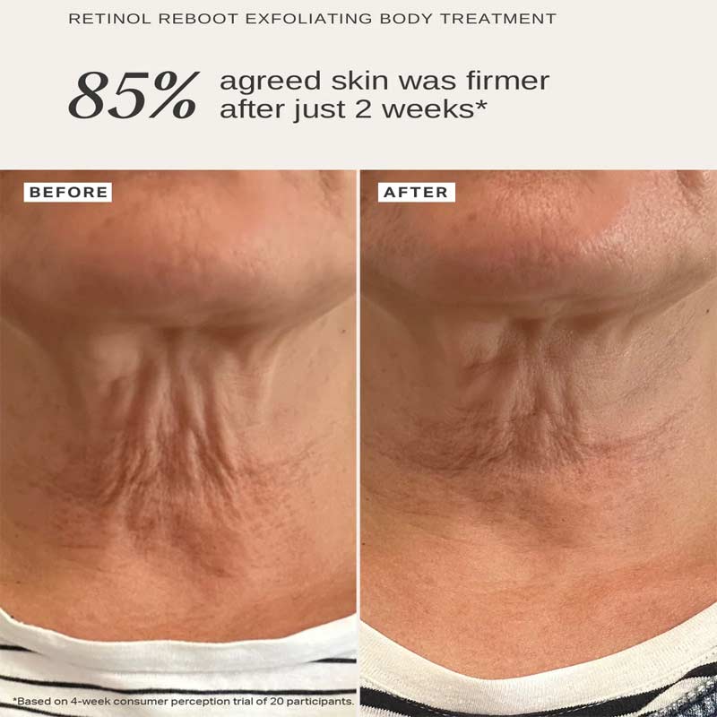 Retinol Reboot Exfoliating Body Treatment 1% Encapsulated Retinol by Alpha-H