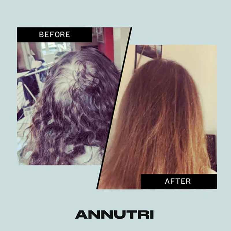 Grow It Hair Growth Supplement 3 Month Supply by Annutri