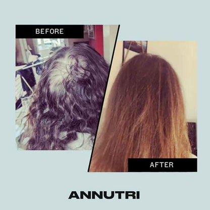 Grow It Hair Growth Supplement 6 Month Supply by Annutri