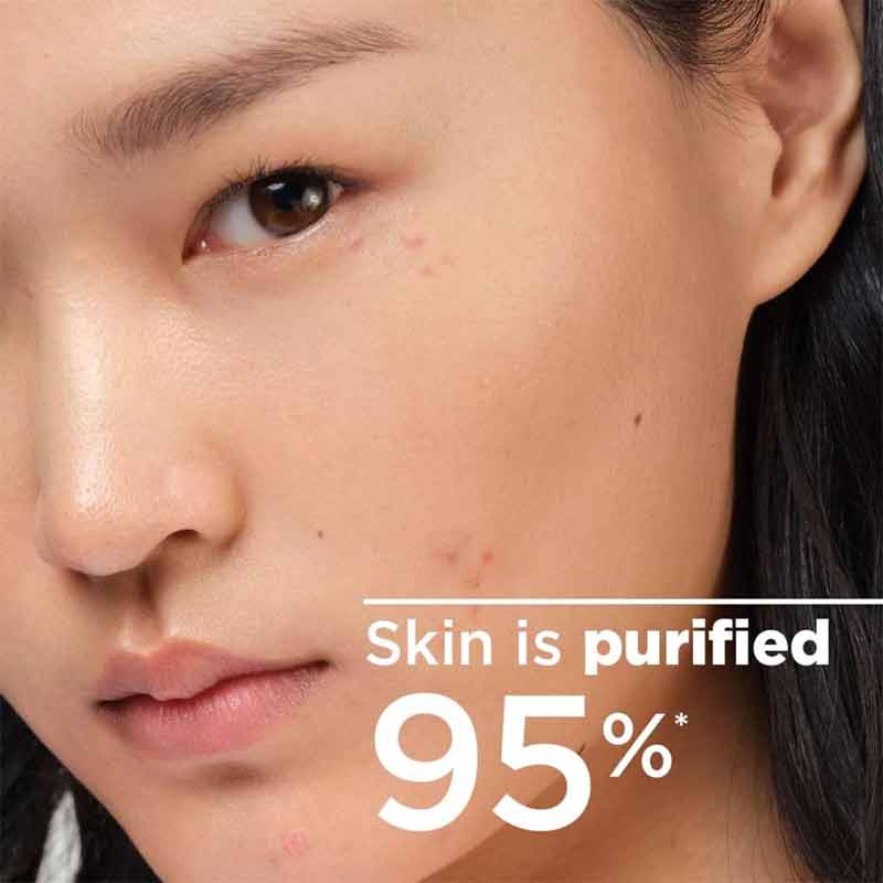 Sebium H2O Purifying Micellar Water Travel Size by Bioderma