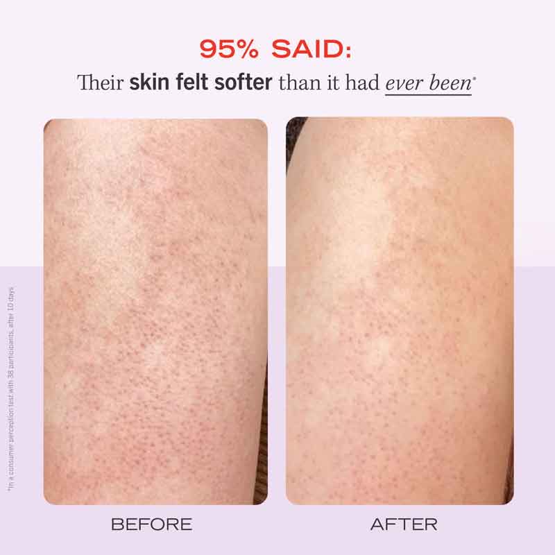KP Bump Eraser Body Scrub Fresh Strawberry by First Aid Beauty