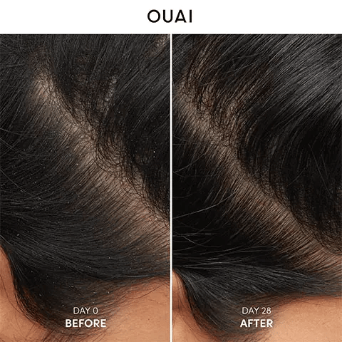 OUAI Anti-Dandruff Shampoo 300ml