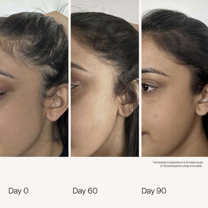 Scalp Care Density Serum by Living Proof