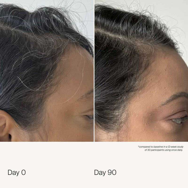 Scalp Care Density Serum by Living Proof