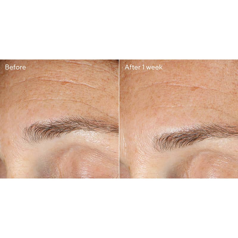 Resurgence Replenishing Multi-Acid Peel 50ml