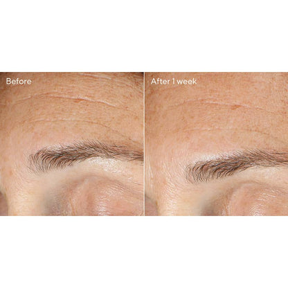 Resurgence Replenishing Multi-Acid Peel 50ml