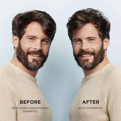 System 1 Scalp & Hair Treatment by Nioxin