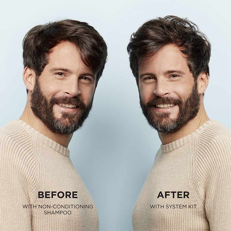 System 2 Three Part Loyalty Kit for Progressed Thinning by Nioxin