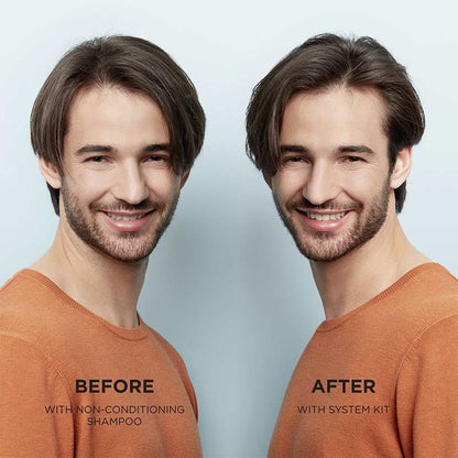 System 2 Three Part Loyalty Kit for Progressed Thinning by Nioxin
