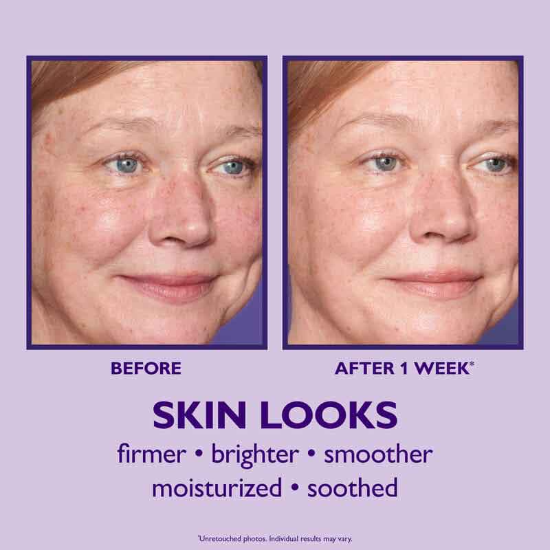 Ultimate Solution 5 Multitasking Moisturiser