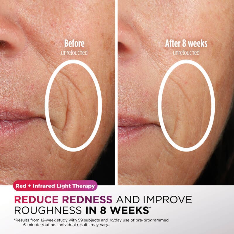 CryoGlow Under-Eye Cooling + LED Face Mask by Shark
