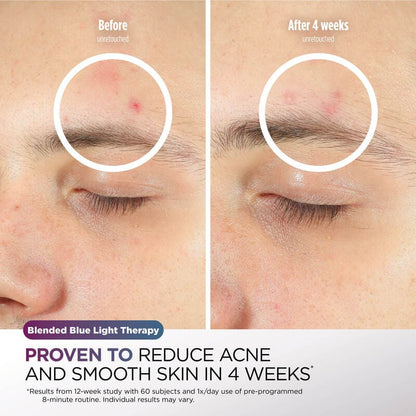 CryoGlow Under-Eye Cooling + LED Face Mask by Shark