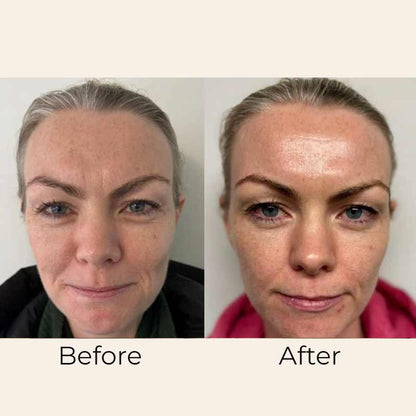 Day Cream Moisturising SPF 50 by Skin Formulas