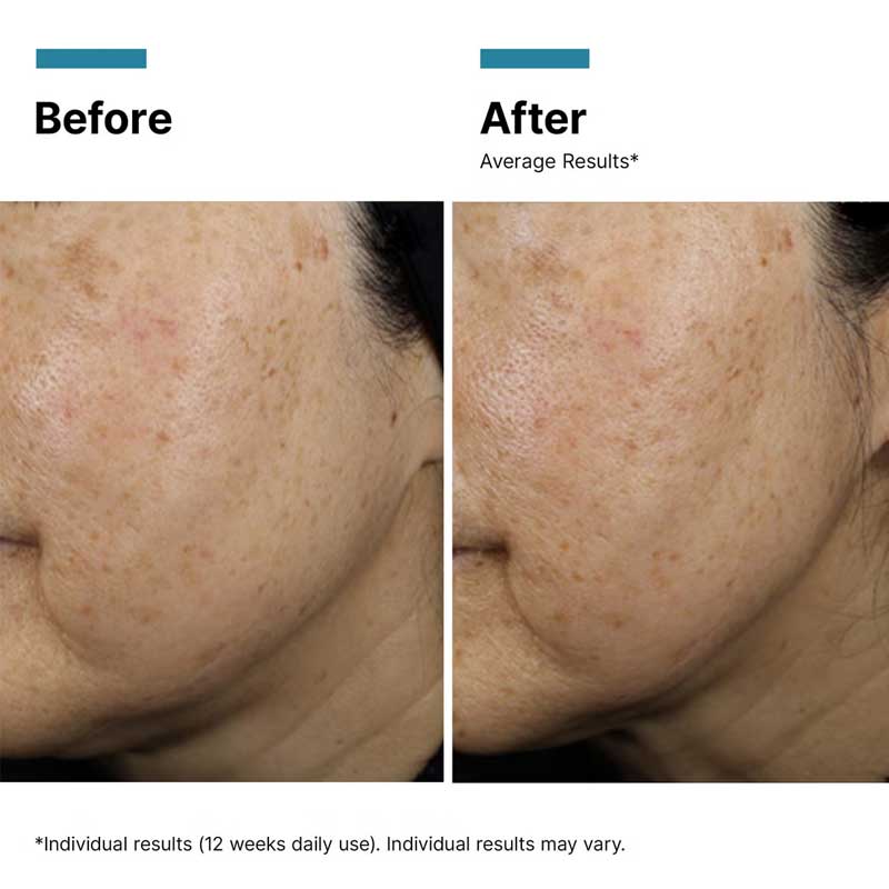 Hydrate & Smooth Exclusive Gift Set by SkinCeuticals