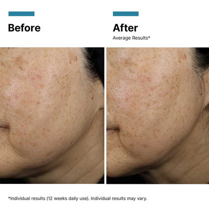 Hydrate & Smooth Exclusive Gift Set by SkinCeuticals